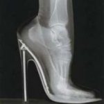 tacco-alto-scarpa-radiografia